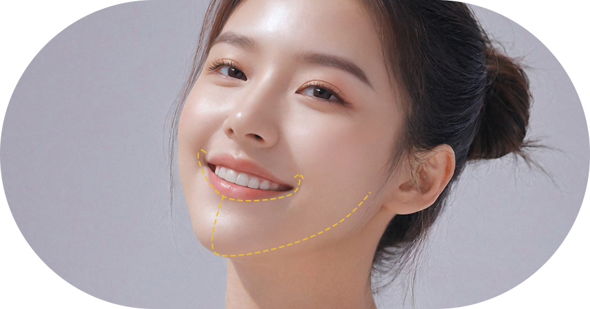 스마일 아크