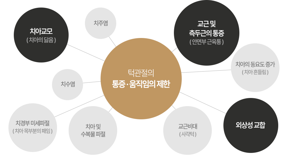 턱관절의 통증 및 움직임 제한 도식