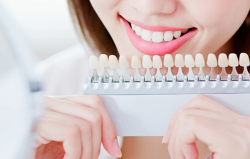 라미네이트